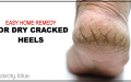 dry heels, cracked heels, how to heal, DIY